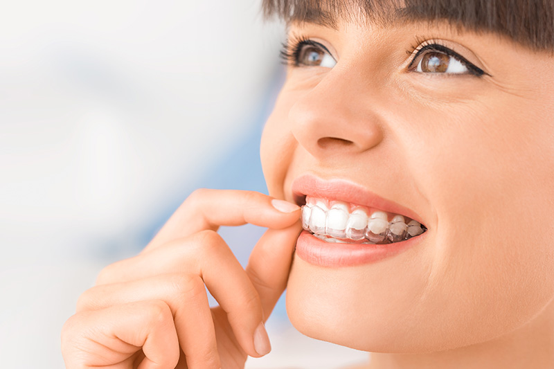 Invisalign in Watsonville